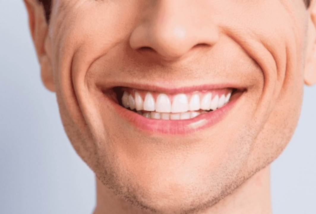 PROTESIS DENTAL FLEXIBLE